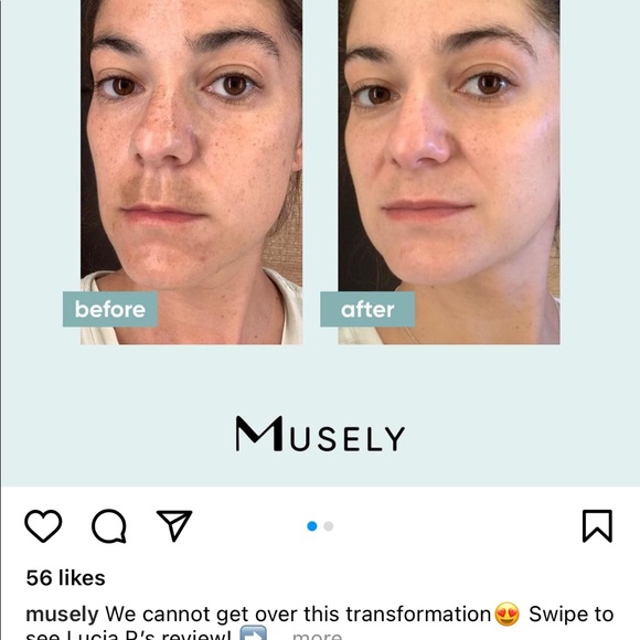 musely spot cream ebay